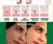 Eelhoe Dark Spot Correcting Glow Serum & Hoygi Niacinamide 10%+TXA 3% Serum